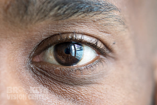 Vision correction services in Brooklyn New York